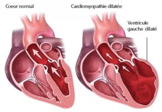 Santé : Tachycardie : les 5 causes qui font battre le cœur trop vite